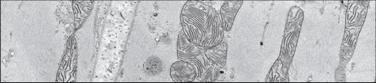 Diatome超薄切片钻石刀(图1)